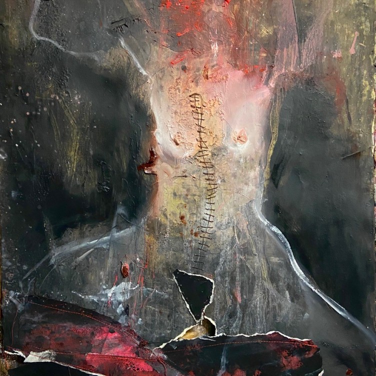 Autopsychic Surgery